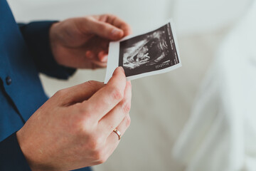 Man holding ultrasound picture of a baby.
