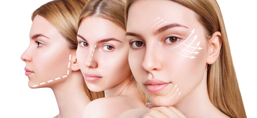 Lifting arrows showing facial anti-aging treatment on skin.