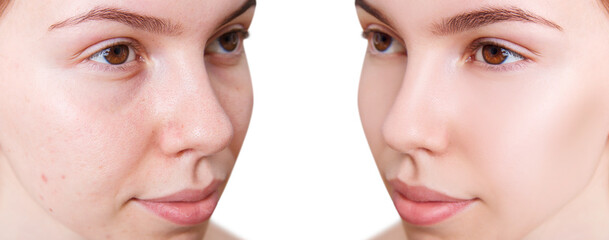 Face of beautiful woman before and after skin retouch.