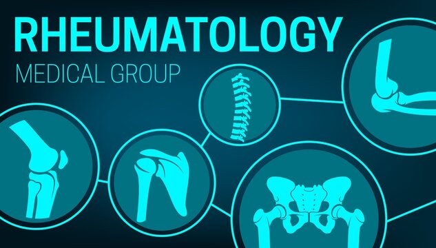 Rheumatology medicine, joints xray, rheumatic disorder medical health care. Vector human skeleton parts elbow, foot and pelvis, spine, knee and shoulder joints mri or computed tomography images poster