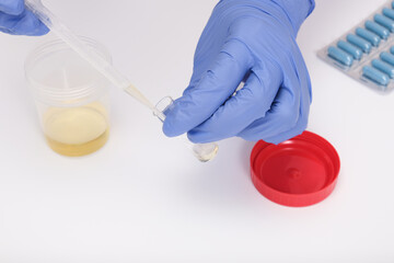 A doctor, lab technician in blue gloves holding urine sample in a plastic container, urinalysis and...