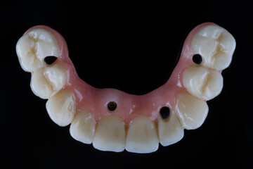 excellent upper jaw prosthesis made of quality materials top view on a black background © Dental Pro Content