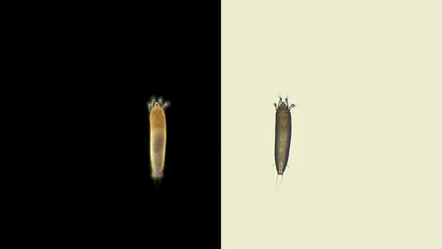 Gall mite (acari) Eriophyoidea under the microscope, order Trombidiformes, is a species of pests of forest and cultivated plants (apple trees, grapes, plums and others). Size 0.1-0.3 mm