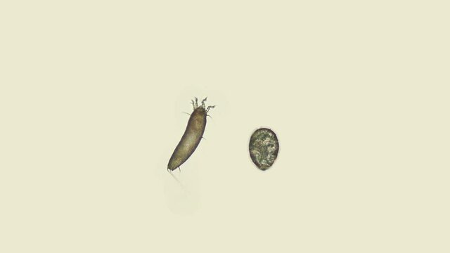 Gall mite (acari) Eriophyoidea under the microscope, order Trombidiformes, is a species of pests of forest and cultivated plants (apple trees, grapes, plums and others). Size 0.1-0.3 mm