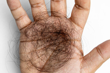 Close-up man's hand is holding hair fall on white screen, hair loss problem, hair lost treatment concept.