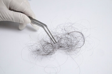 Hair loss specialist, wearing gloves, using forcep to pick up hair for examination. On white background with copy space. 