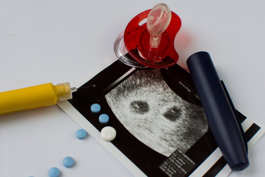 Ultrasonogram picture, syringe with a thin needle and some pills.