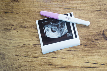 Positive pregnancy test and an ultrasound picture.