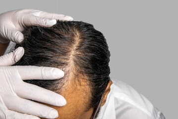 Man visit dermatologist for his hair fall problem. Checking and treatment concept. There are copy space on right hand. 