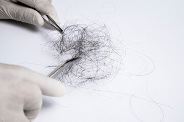 Hair loss specialist, wearing gloves, using forcep to pick up hair for examination. On white background with copy space.