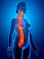 3d rendered medically accurate illustration of a high lighted spine
