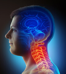 3d rendered, medically accurate illustration of male   having a painful neck