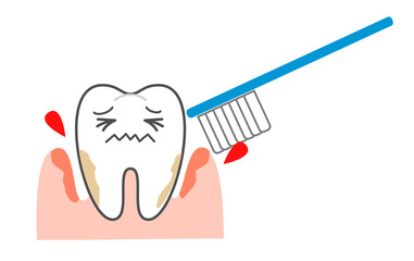 Periodontal disease bleeding toothpaste 　illustrations