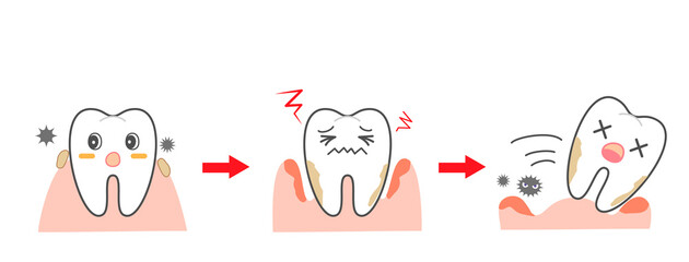 Periodontal disease bleeding toothpaste 　illustrations