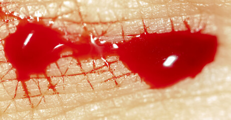 Close-up of blood from a wound on a human skin.