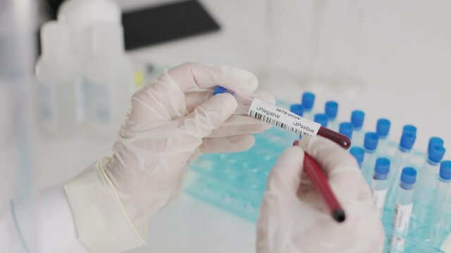 Coronavirus COVID-19 Negative concept Closeup of microbiologist or medical worker hand with surgical gloves marking blood test result as negative for the new rapidly spreading 