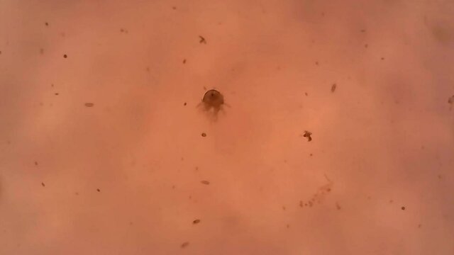 Microscope Zooplankton Freshwater Pond Harpacticoida 1200x