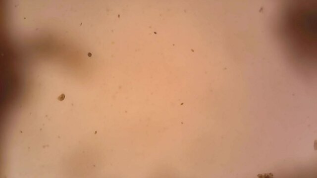 Microscope Zooplankton Freshwater Pond Ostracods 1000x