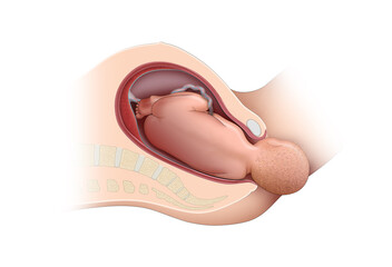 Obraz premium Childbirth. Leaving babies in the womb