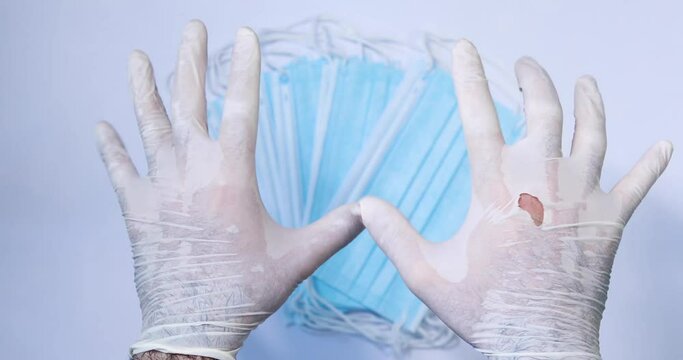 Doctor, client showing poor quality medical, protective glove