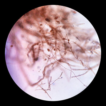 Microscopy 14