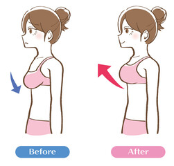バストアップ　ビフォーアフター 　イラスト