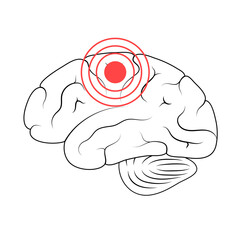 Pain Brain Illustration