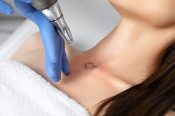 Doctor beautician makes laser tattoo removal on the neck of a young brunette woman in the salon....