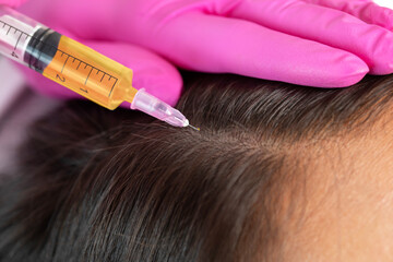 Cosmetologist does prp therapy against hair loss and anti-dandruff of a beautiful woman in a beauty salon. Cosmetology concept.