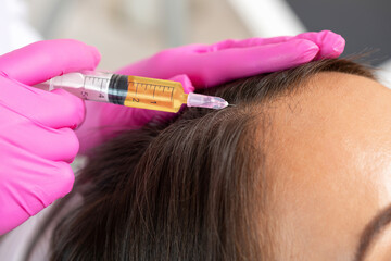 Cosmetologist does prp therapy against hair loss and anti-dandruff of a beautiful woman in a beauty...