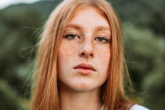 Teen Freckle