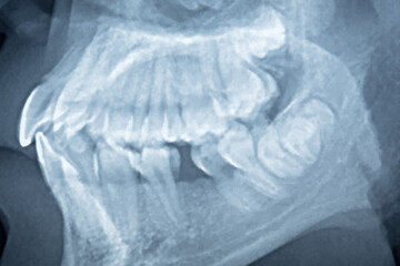 panoramic dental x-ray of a mouth.