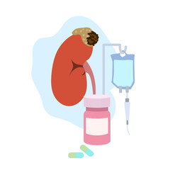 Adrenal gland tumor. Disease. Treatment, pills, bottle, drop counter, dropper. Medical flat anatomy illustration.