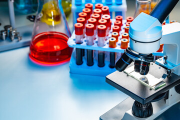 Close up photo of microscope with test tubes with blood samples