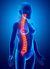 .3d rendered medically accurate illustration of girl  high lighted spine