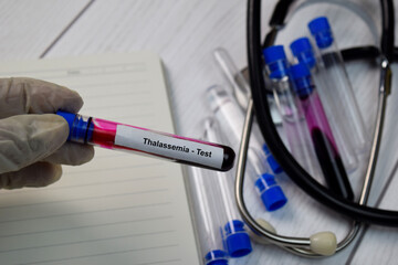 Thalassemia Test text with blood sample. Top view isolated on black background. Healthcare/Medical...