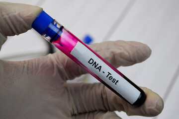 Obraz premium DNA Test text with blood sample. Top view isolated on black background. Healthcare/Medical concept