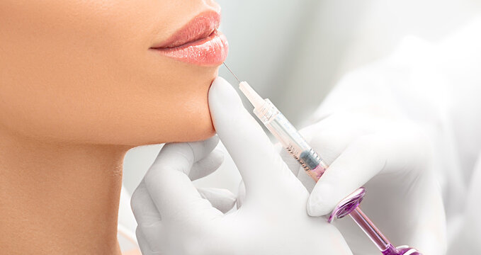 Woman having procedure lip augmentation. Syringe near womans mouth, injections for increase lips shape
