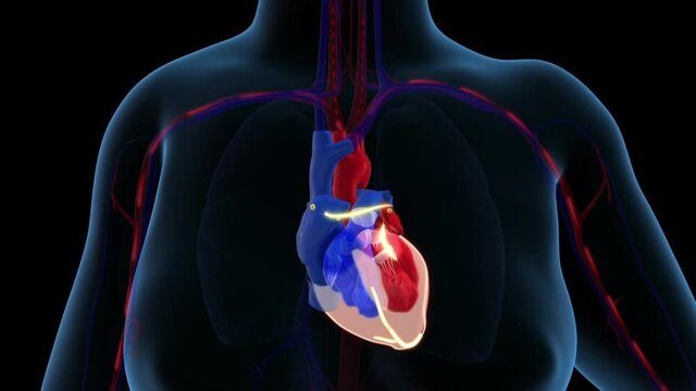 Irregular heartbeat (arrythmia) and atrial fibrillation of a human heart