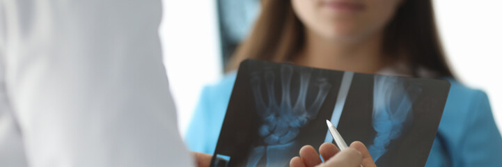 Close-up of doctor hands holding skiagram. Surgeon talking about wrist trauma. Smiling intern listening carefully to traumatologist. Traumatology and health care concept