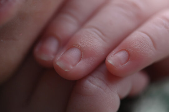 Foto em detalhe das unhas e dos dedinhos de um beb&ecirc;