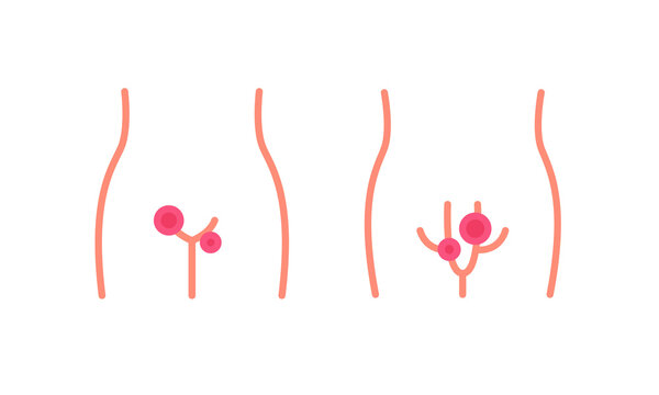 genital herpes flat icon, vector color illustration