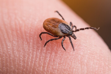 Female deer tick on skin of human finger. Ixodes ricinus or scapularis. Close-up of dangerous parasitic mite in dynamic motion on fingertip with friction ridges. Diseases transmission as encephalitis.