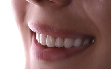 Obraz premium Perfect healthy teeth beautiful wide smile bleaching procedure whitening of young smiling attractive sexy lips woman. Dental restoration treatmentClose Up oral care dentistry, stomatology Dentistry