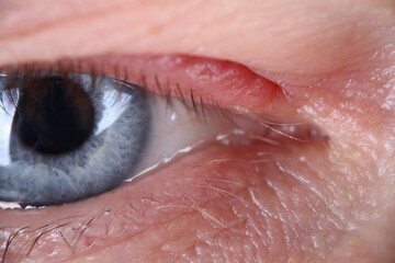 Fototapeta premium Close-up of elderly mans eye. Macro shot of senior male looking in camera. Beautiful blue colour eyeball. Wrinkles and moles. Youth and ageing. Natural appearance concept