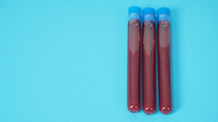 Blood test tubes isolated on blue background.