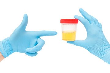urine sample analysis in a jar in hands gloves by a doctor or a bio lab worker. Urology and kidney diseases and urinary tract infections concept.