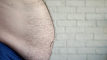 Fototapeta premium Obese Man Showing His Fat Belly, a Hungry Person Measuring His Belly Fat, Health Problems of an Old Man with Obesity