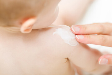 Young mother fingers applying white moisturizing cream on baby shoulder. Care about children clean...
