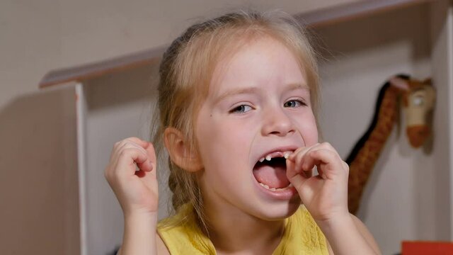 Little girl has her front loose tooth. Milk teeth are ready to drop. The child is happy to grow up